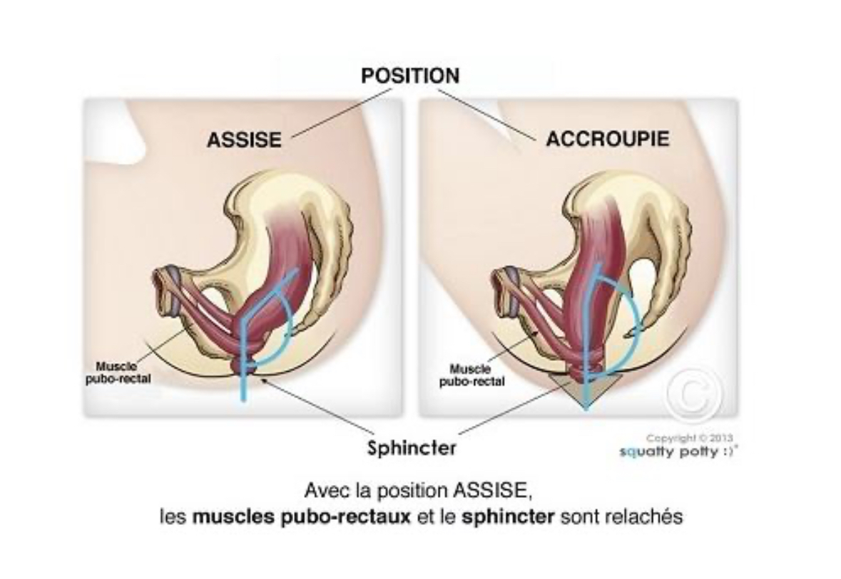 Position accroupie avec le pot anatomique